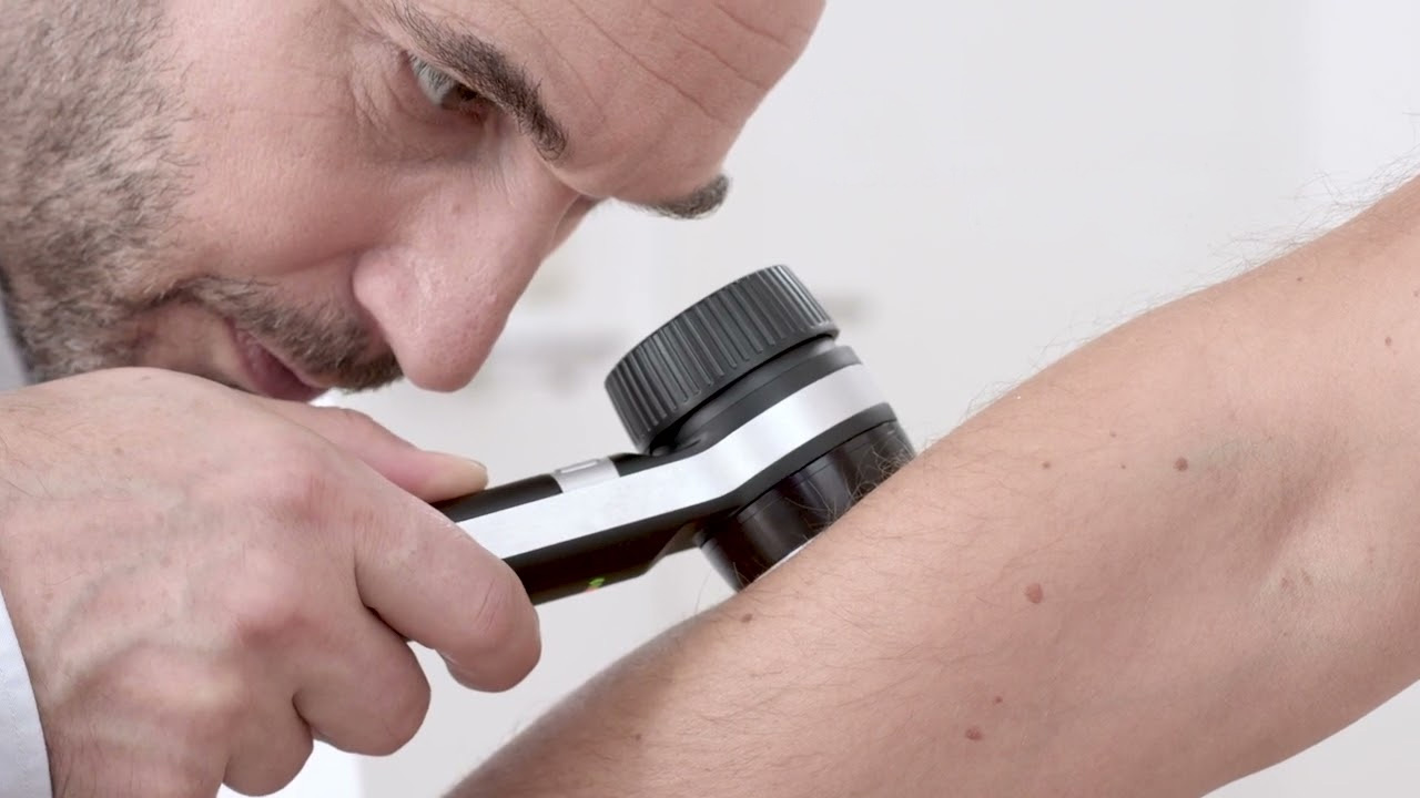 Skin Care - Melanoma Detection, Management & Events